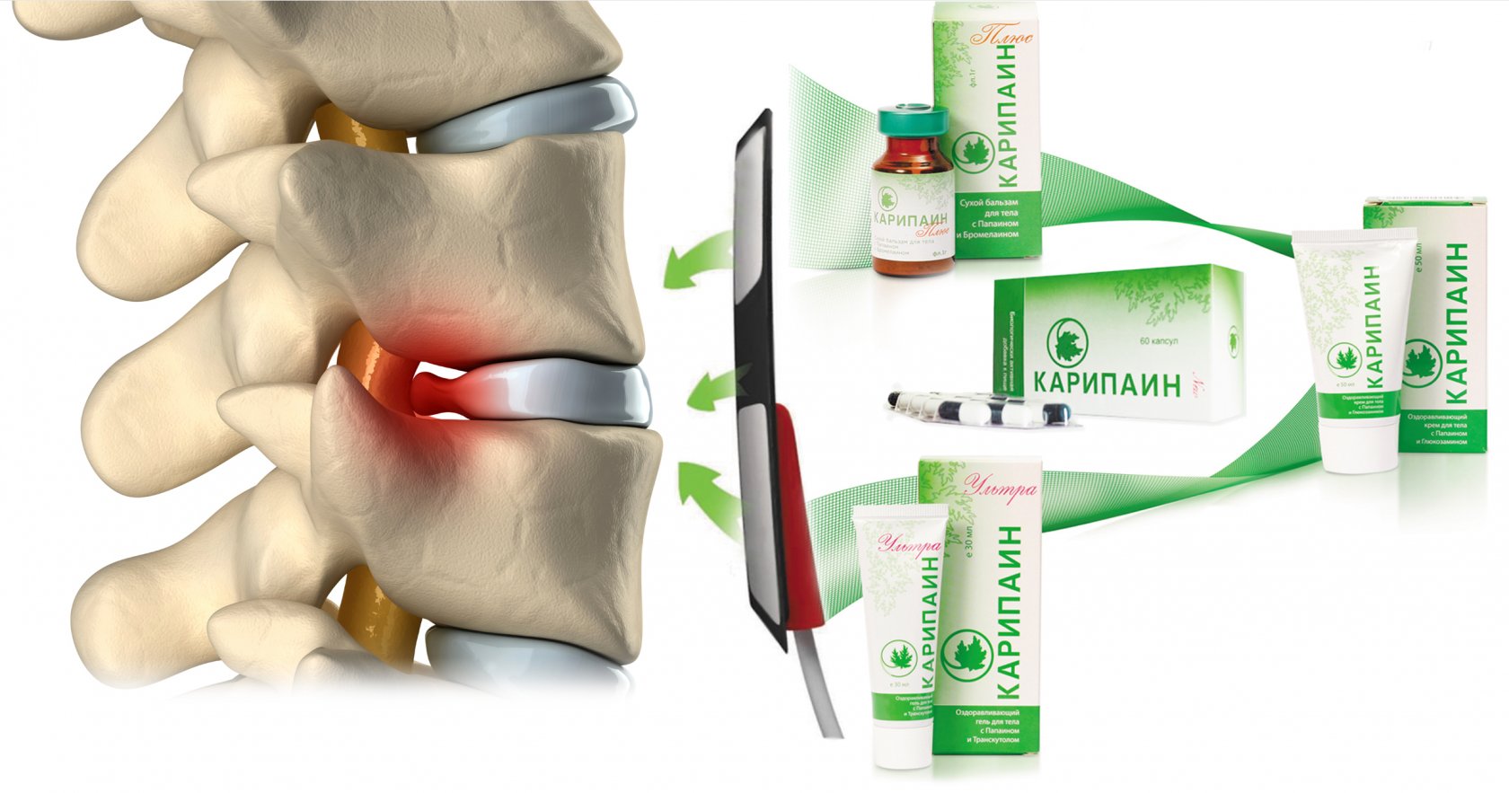 При грыже можно делать электрофорез. Препарат для электрофореза Карипаин. Карипаин мазь для позвоночника. Мазь от грыжи позвоночника карипазимом. Мазь Карипаин для позвоночной грыжи.