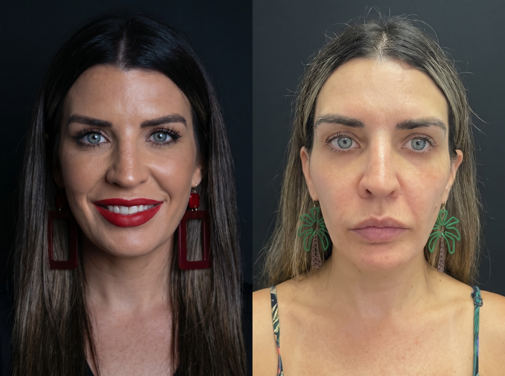 что происходит с лицом при похудении ozempic face
