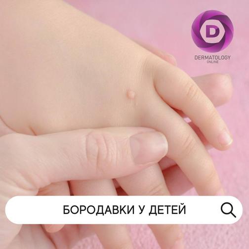 Бородавки у детей, причины , лечение