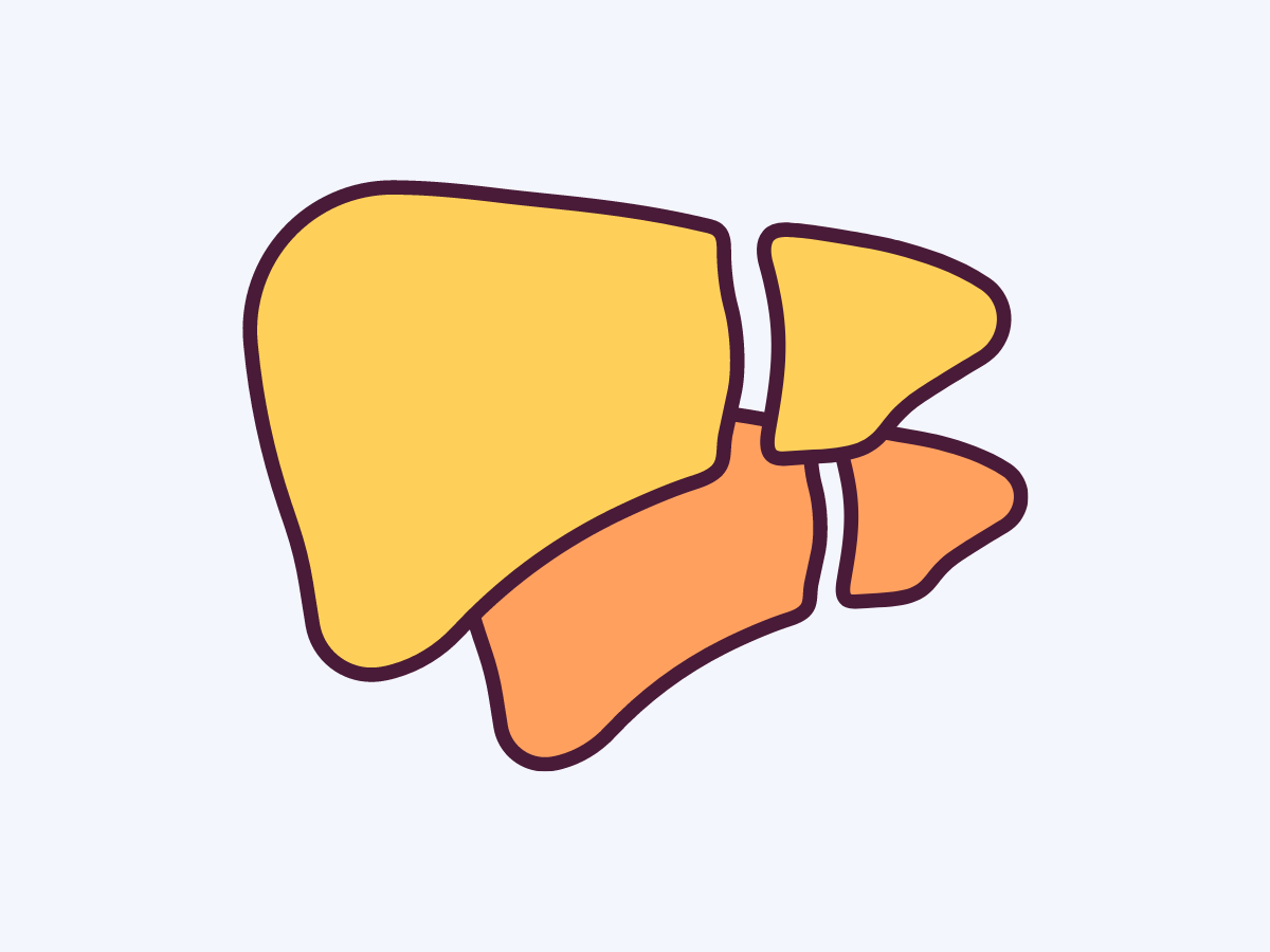 Гипербилирубинемии новорожденных