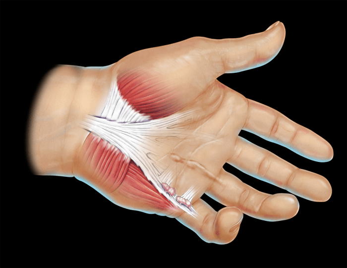 Боль в суставах рук и ног: причины и лечение патологии