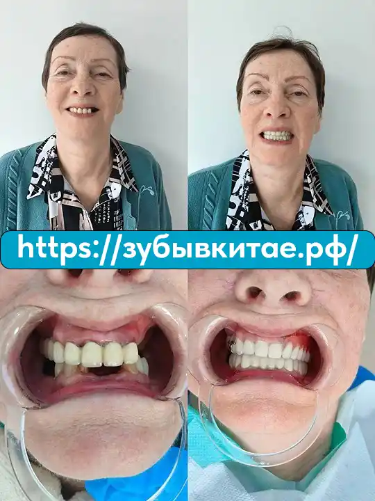 До и после — кейс 1