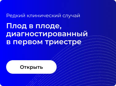 ПЛОД В ПЛОДЕ, ДИАГНОСТИРОВАННЫЙ В ПЕРВОМ ТРИМЕСТРЕ