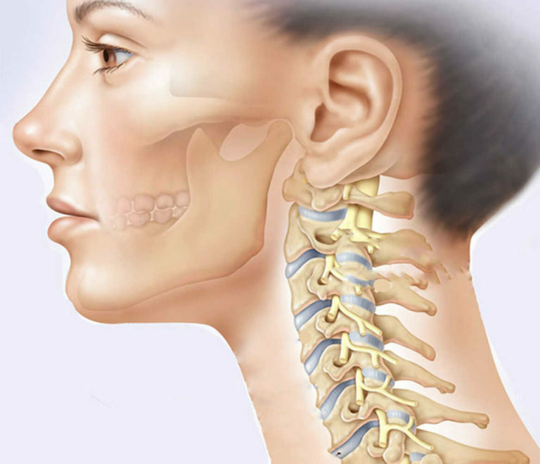 Цервикалгия (боль в шее) - лечение, симптомы, причины, диагностика | Центр Дикуля