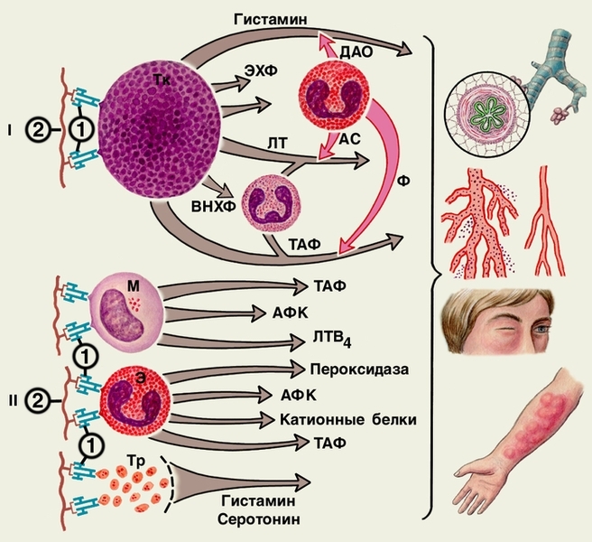 Механизмы аллергических реакций таблица
