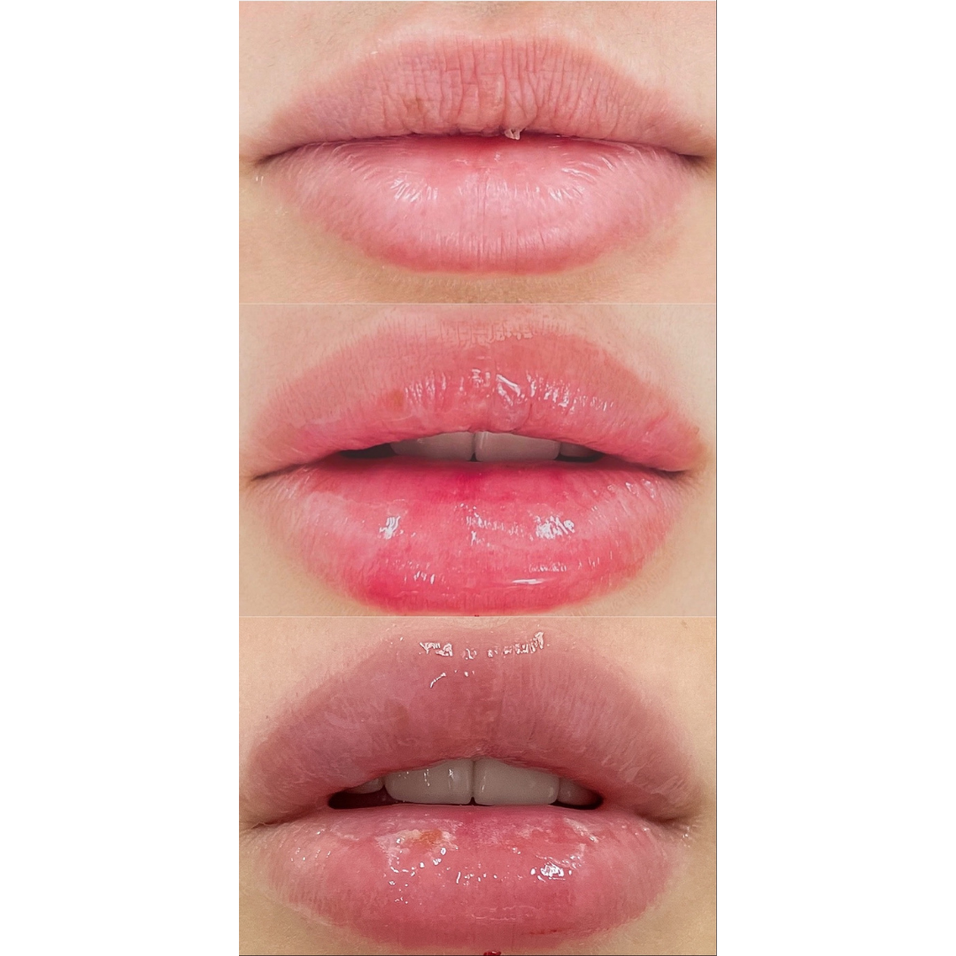 Акции косметолог врач Краснодар