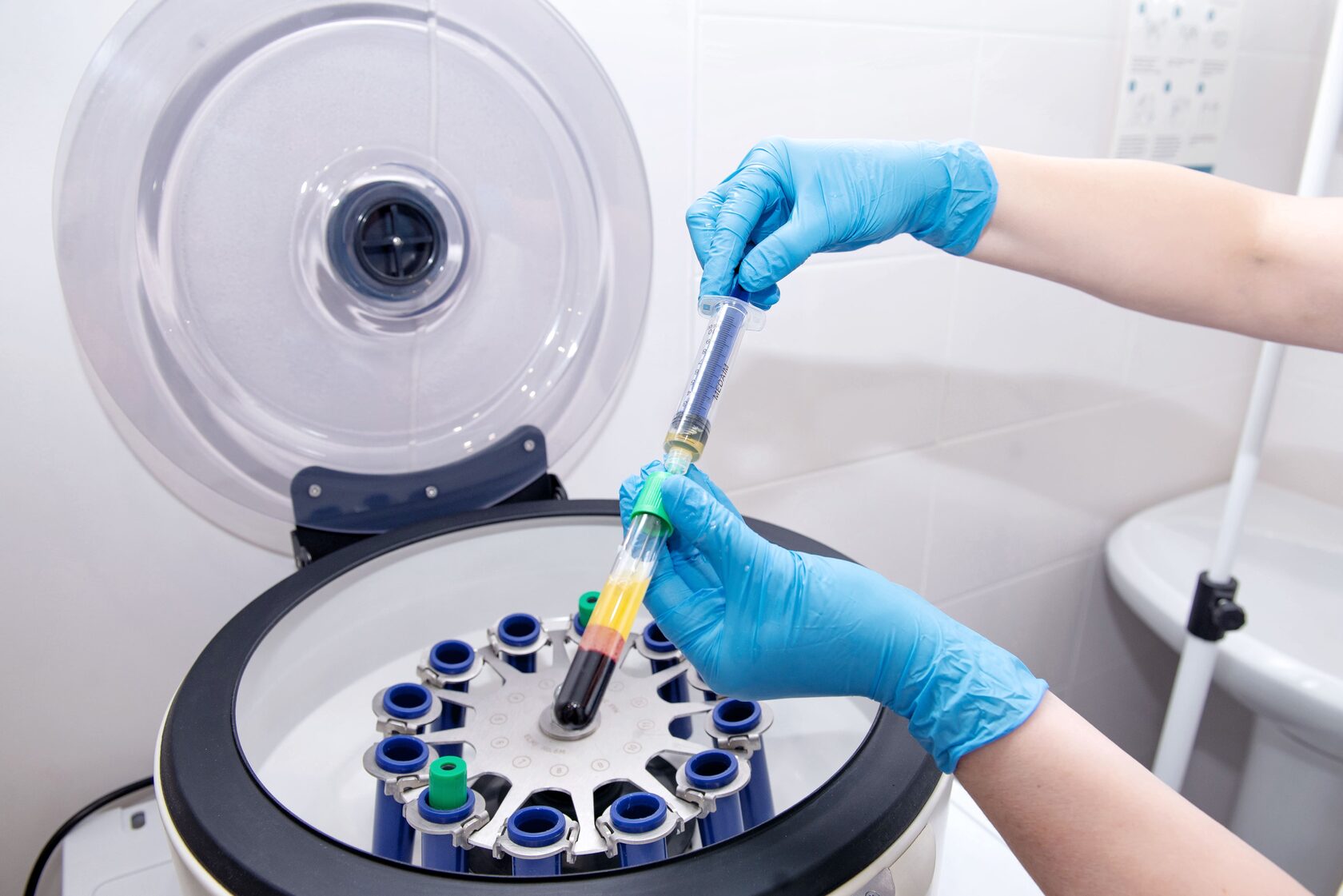 Плазмотерапия