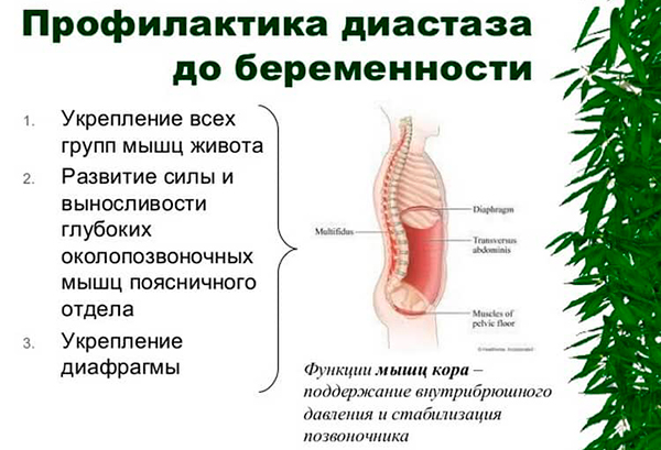 Диастаз 2 степени фото