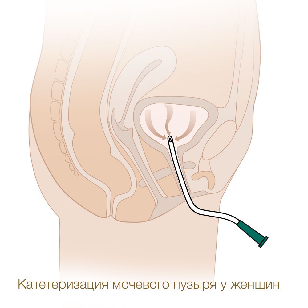 силиконовые урологические презервативы. mederen