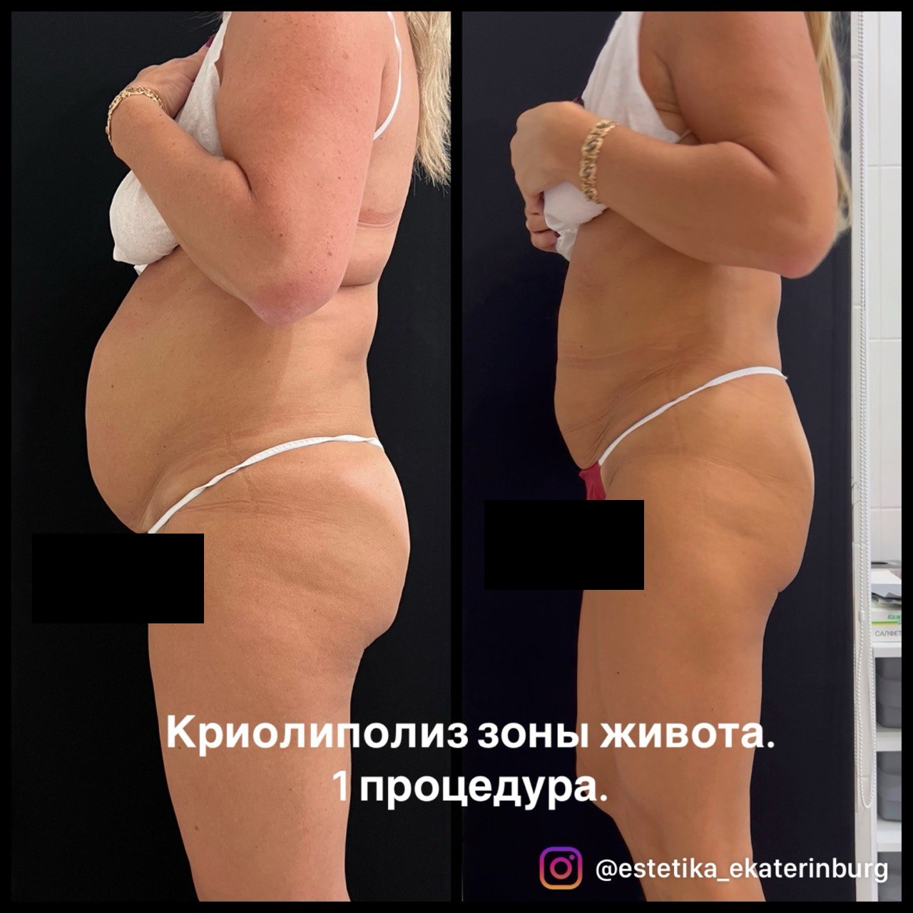Пример результата Clatuu