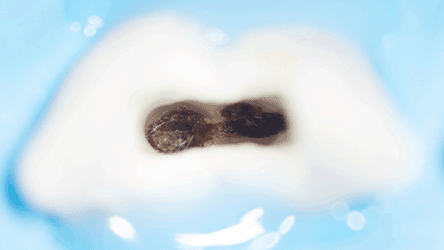 Лечение корней под микроскопом