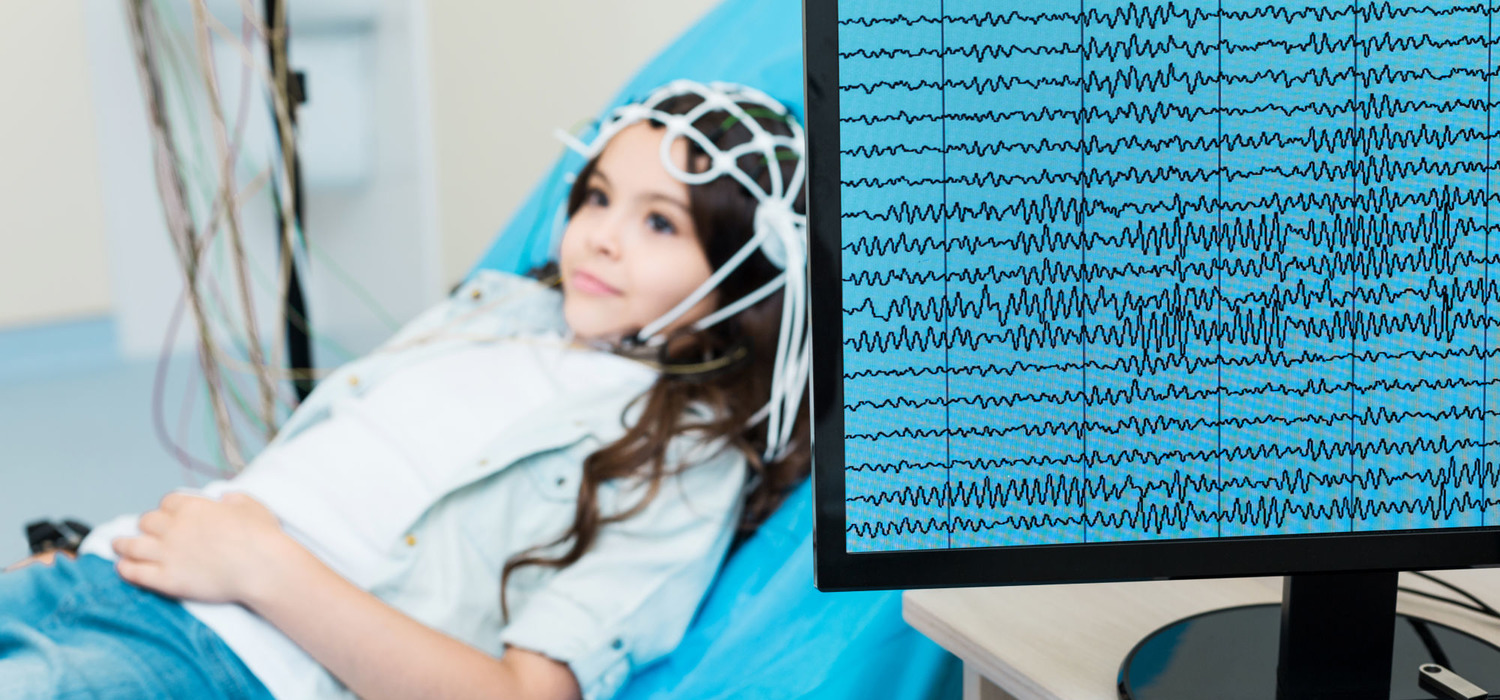 Ээг вм. Электроэнцефалограф Neurofax EEG-1100 K. Электроэнцефалография головного мозга (ЭЭГ). РЭГ И ЭЭГ. Транскраниальная электроэнцефалограмма.