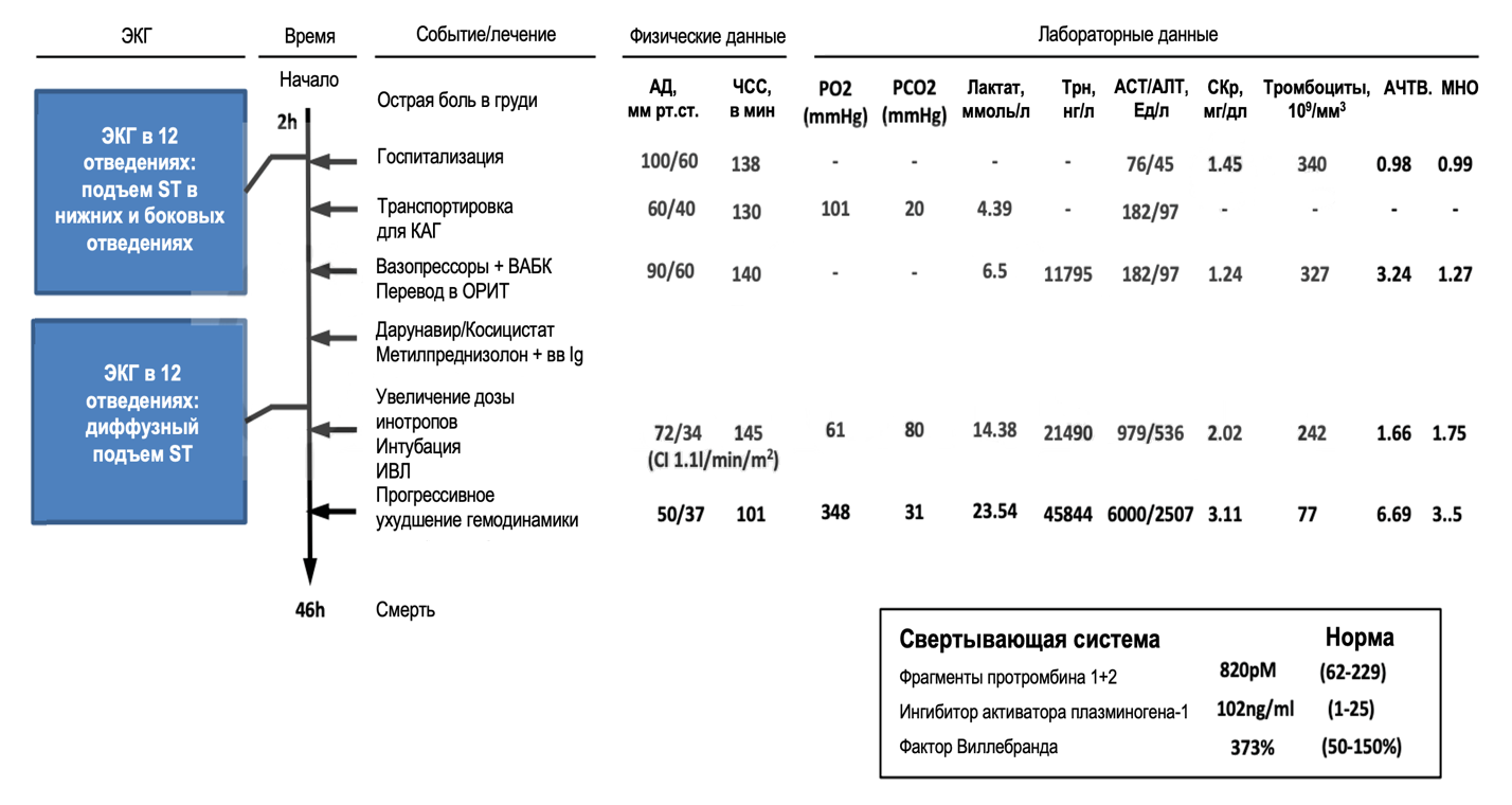 Микротромбы и инфаркт миокарда с подъемом сегмента ST у пациентки с COVID-19