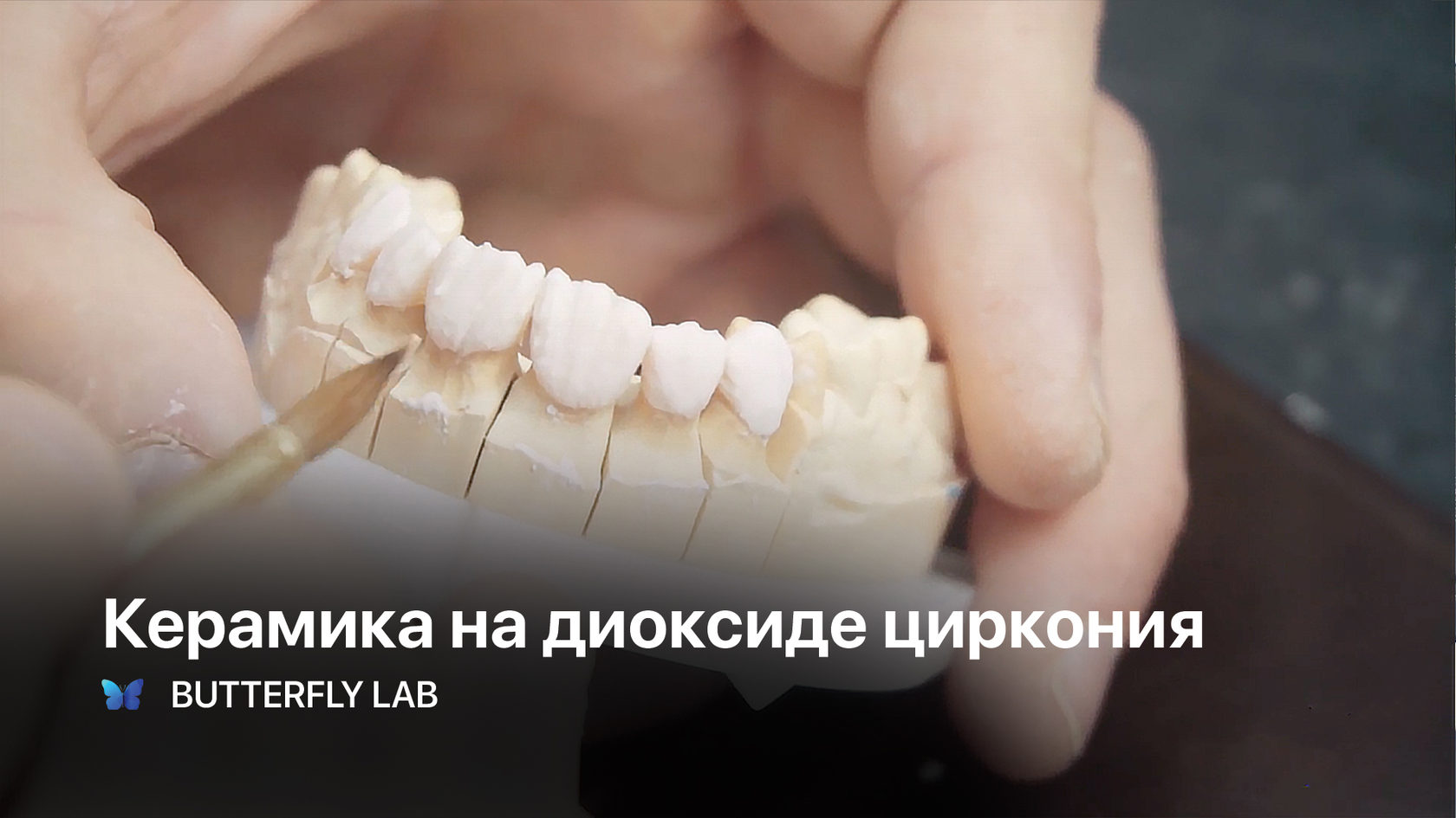 Эстетическая карта пациента