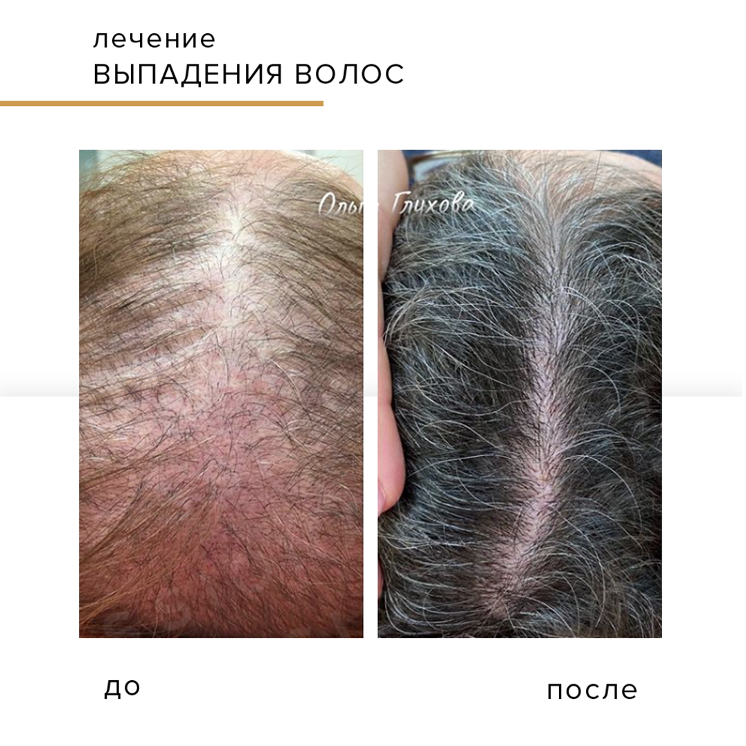 Наращивание волос фото до и после