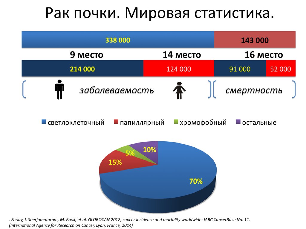 Сколько людей умирают от рака в год. Онкология статистика. Статистика онкозаболеваний. Статистика заболеваний почек. Статистика по заболеваниям почек.