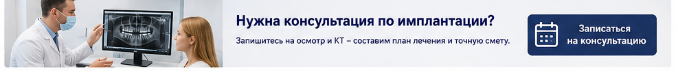 Консультация по имплантации зубов и составление плана лечения в Реутове