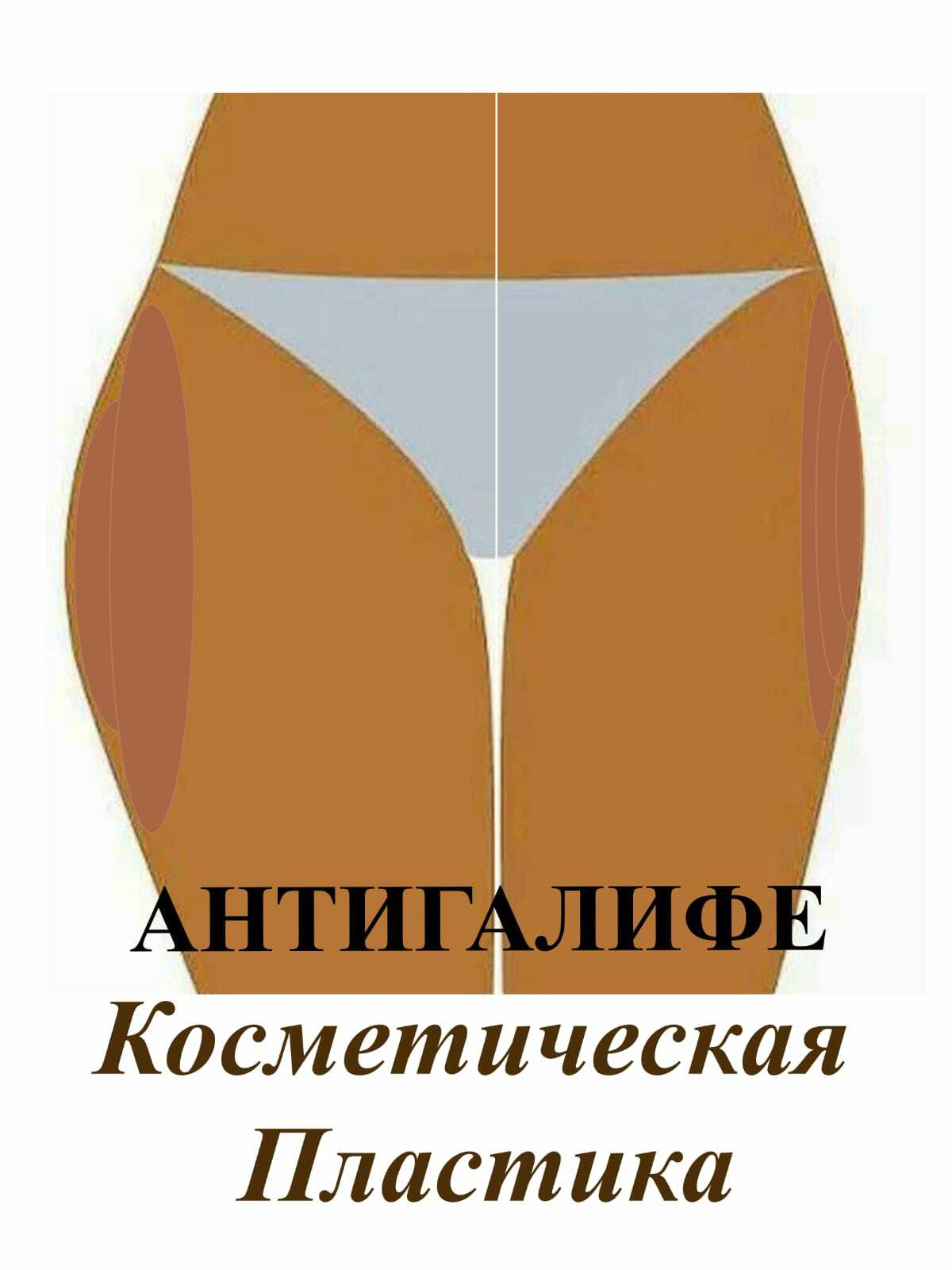 Антигалифе Косметическая Пластика в Москве