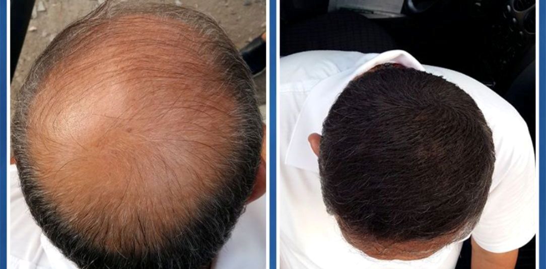 Пудра для волос - придаем объём и цвет локонам Косметика для волос, Коротковолос