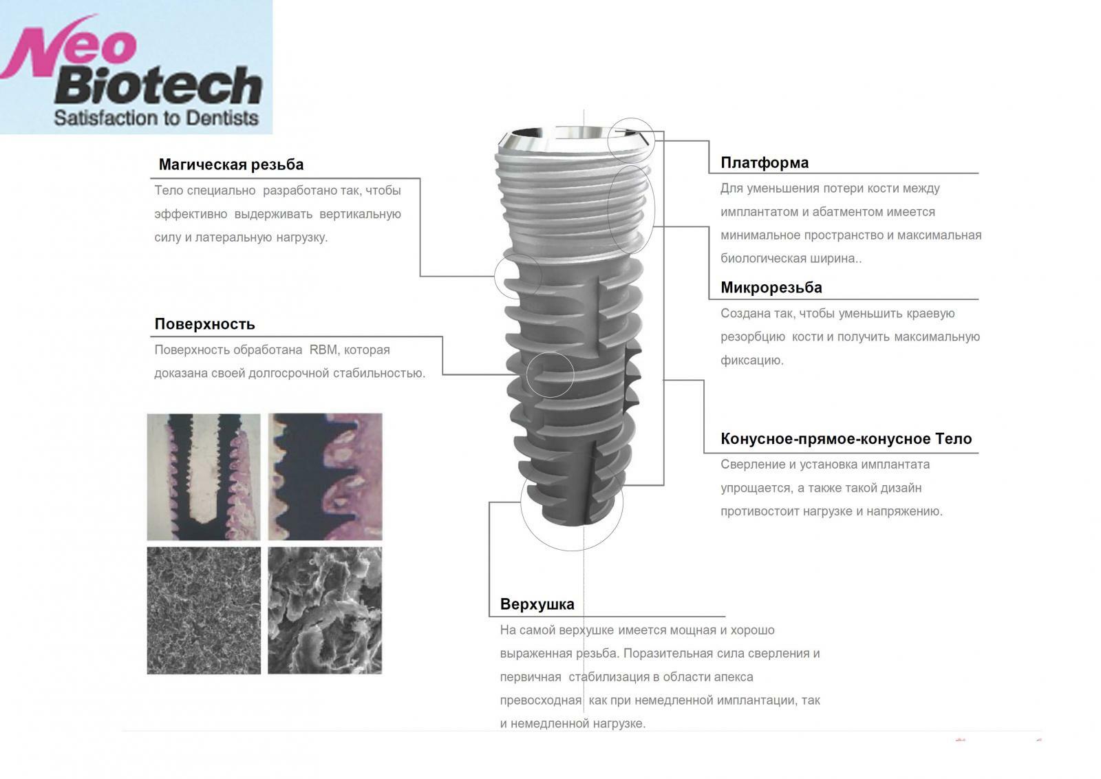 Имплант необиотек. Имплантация системы NEOBIOTECH. Имплантаты Необиотек NEOBIOTECH. Имплант NEOBIOTECH Южная Корея. CMI NEOBIOTECH имплантаты.