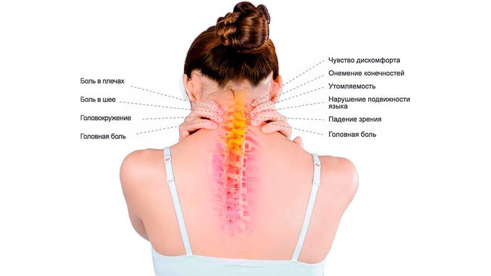 симптомы остеохондроза