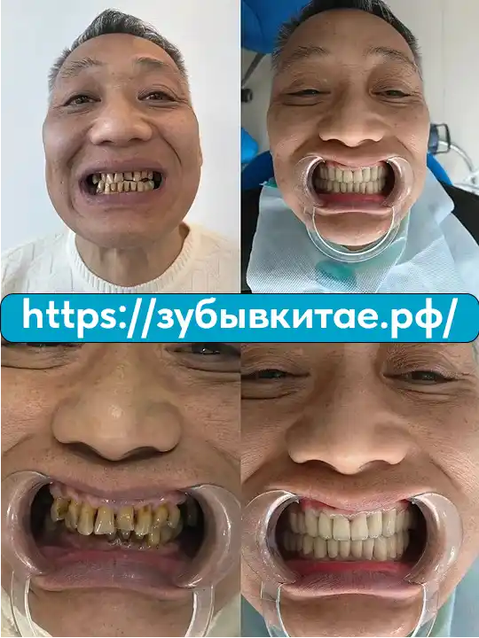 До и после — кейс 10