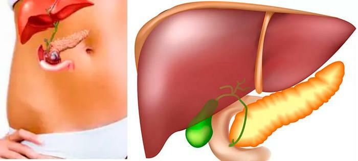 Реабилитация в санатории после удаления желчного пузыря
