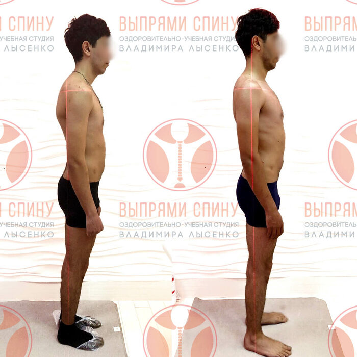 Ровная осанка у мужчины. Выпрямление поясницы. Выпрямление позвоночника. Мышца выпрямляющая позвоночник. Возможно ли выпрямить.