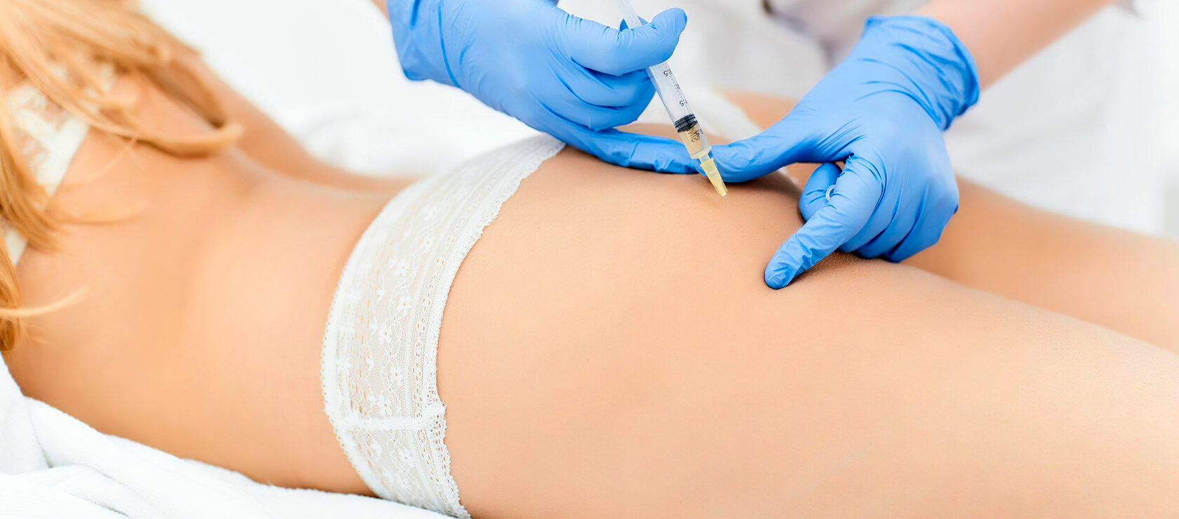 Липофилинг Тела