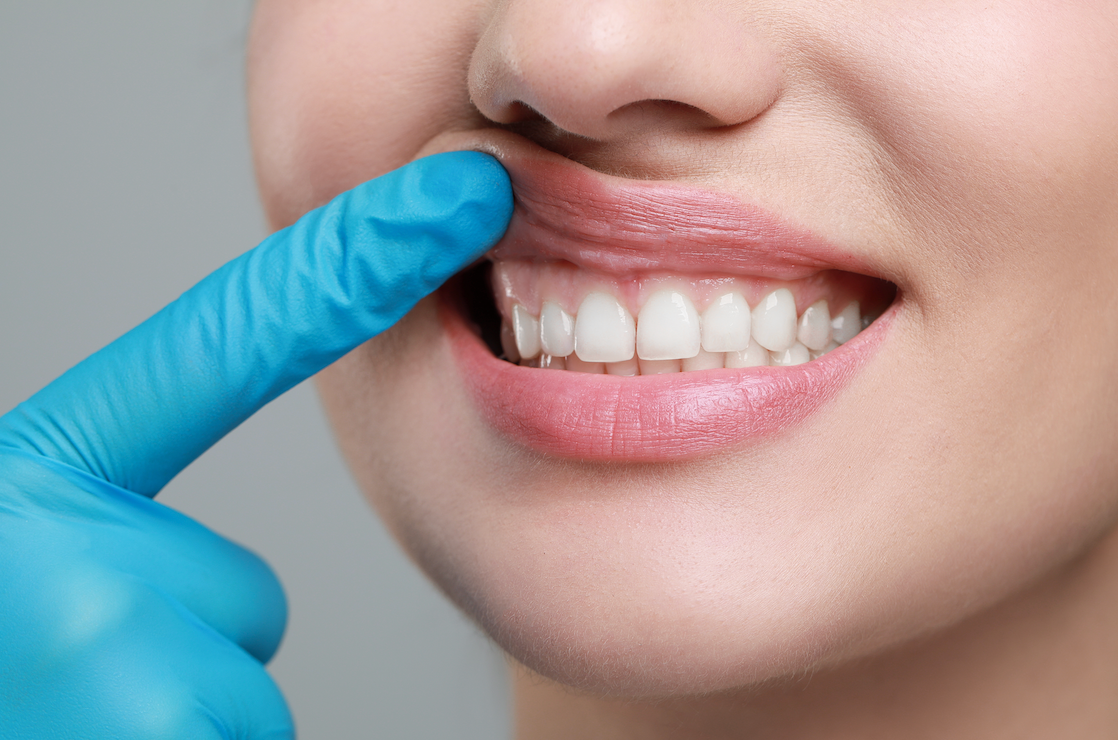 Услуги стоматологии Эволюция в Красногорске