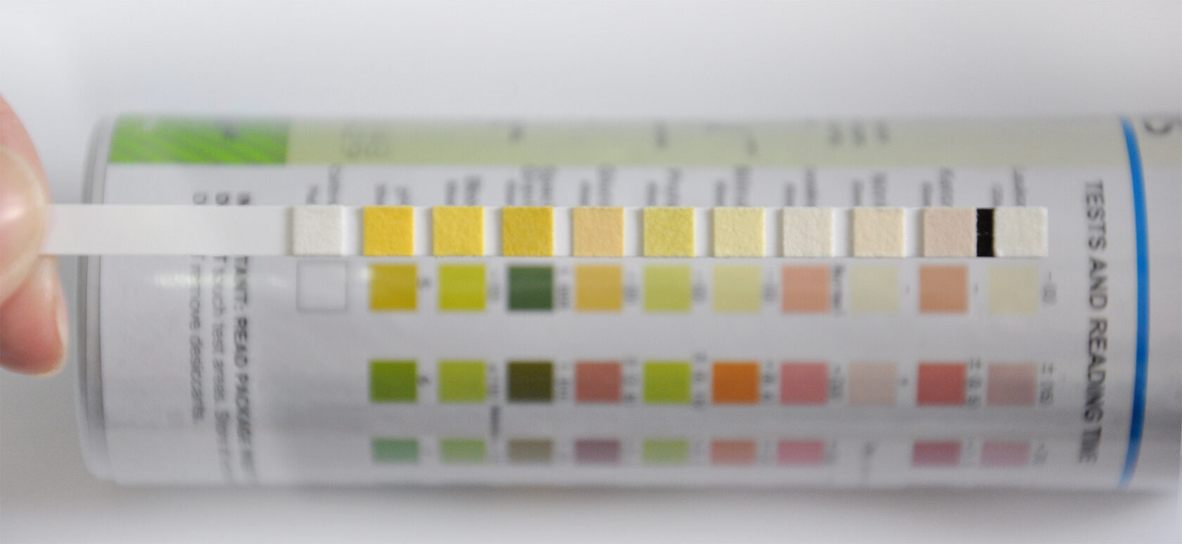 Urinalysis Analyzers And Urine Strips 