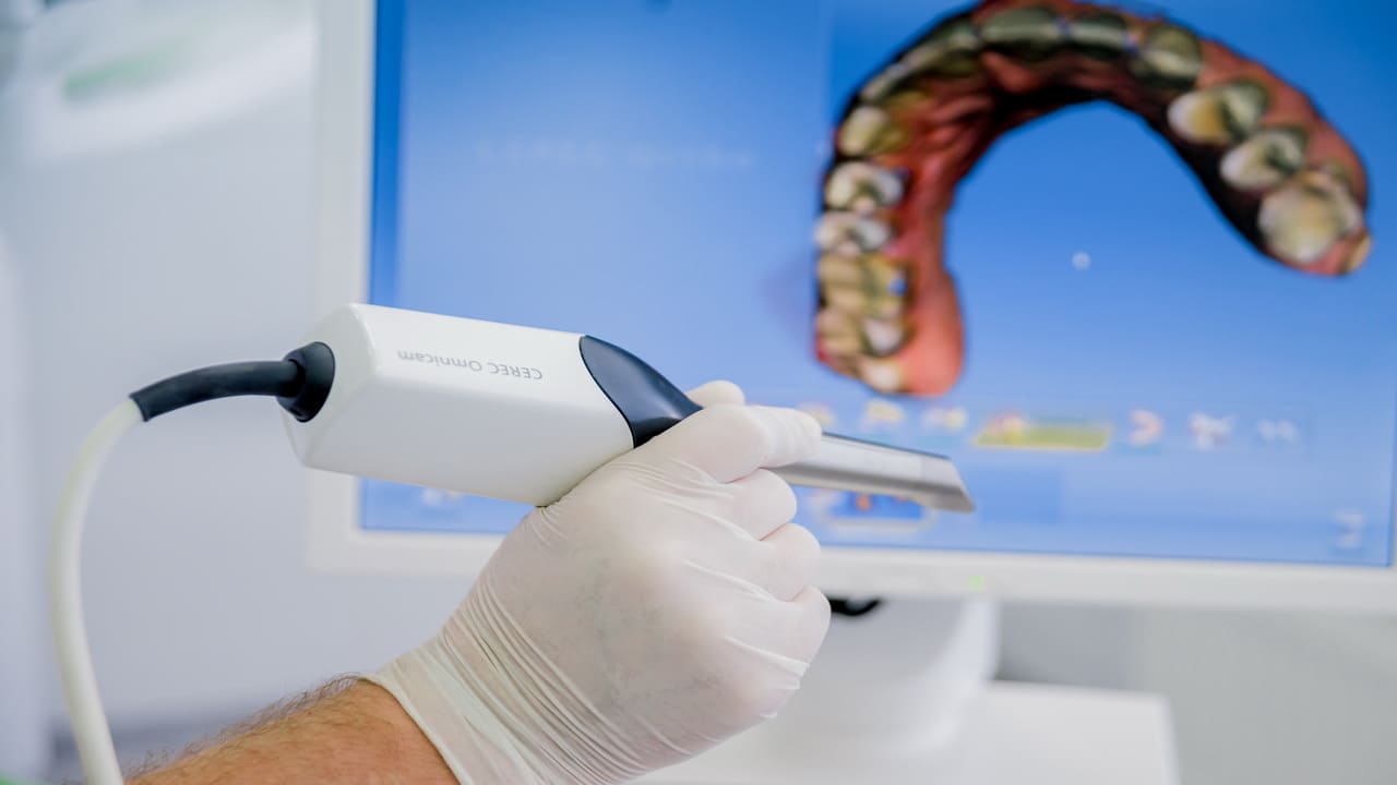 Сканирование зубов Медентис Блог 5