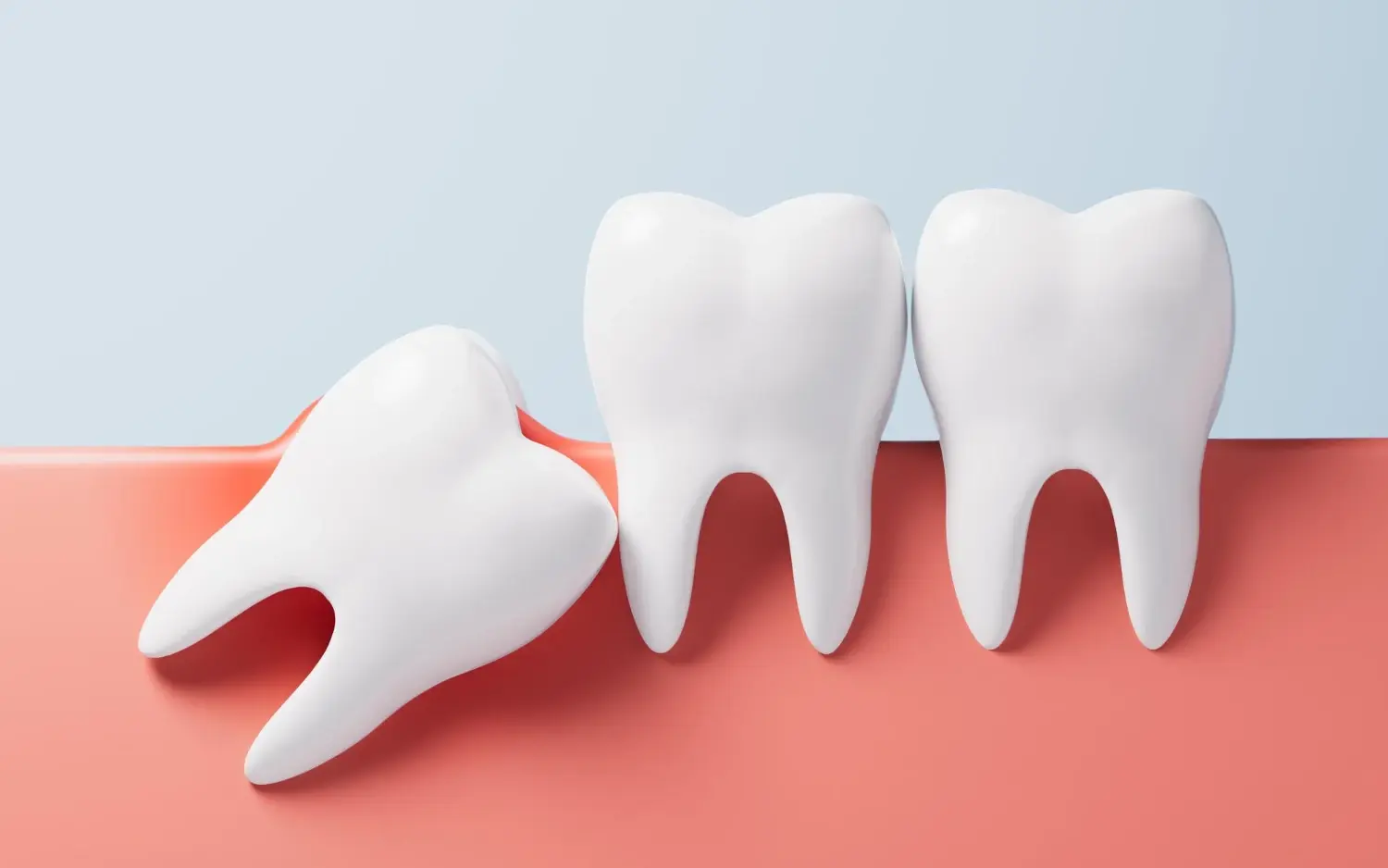 Безболезненное удаление зуба мудрости в стоматологии GoodSmile в Балашихе