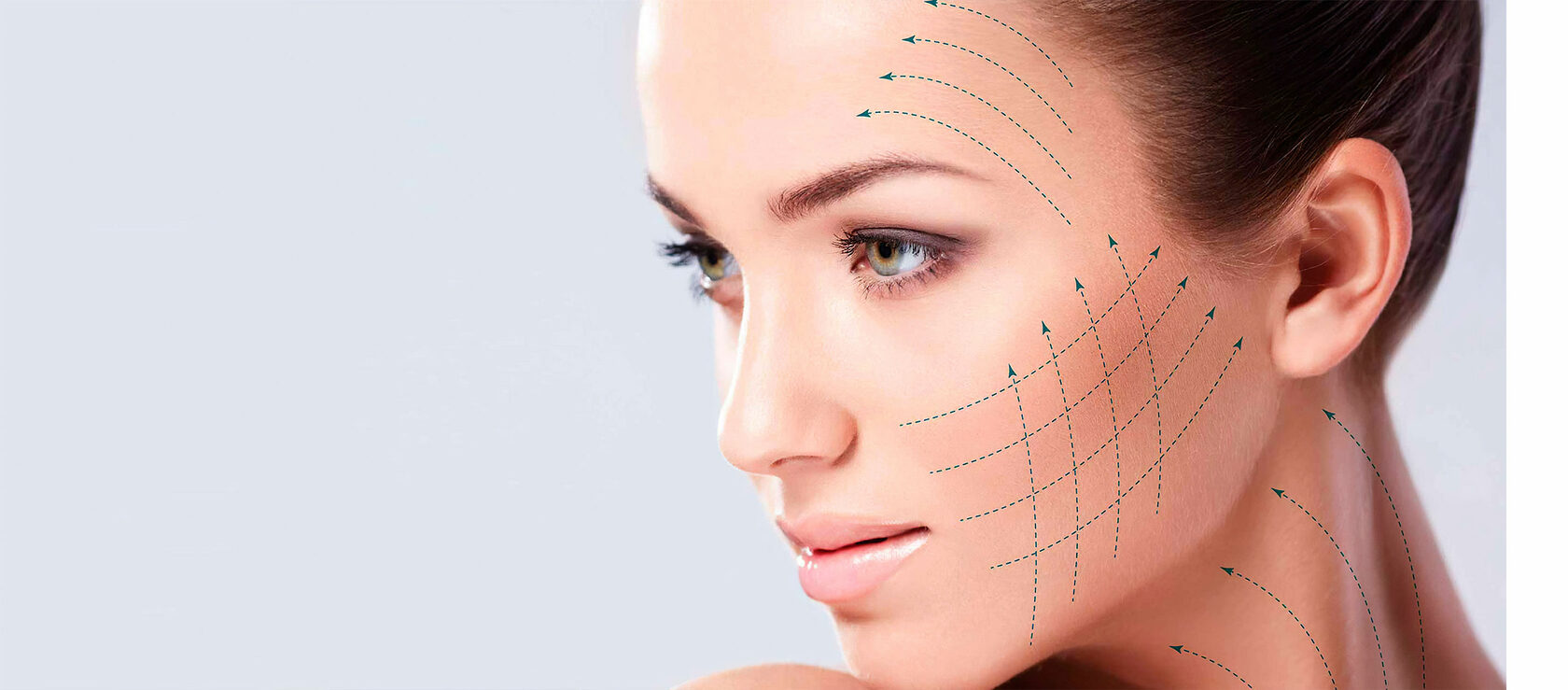 Фейслифтинг