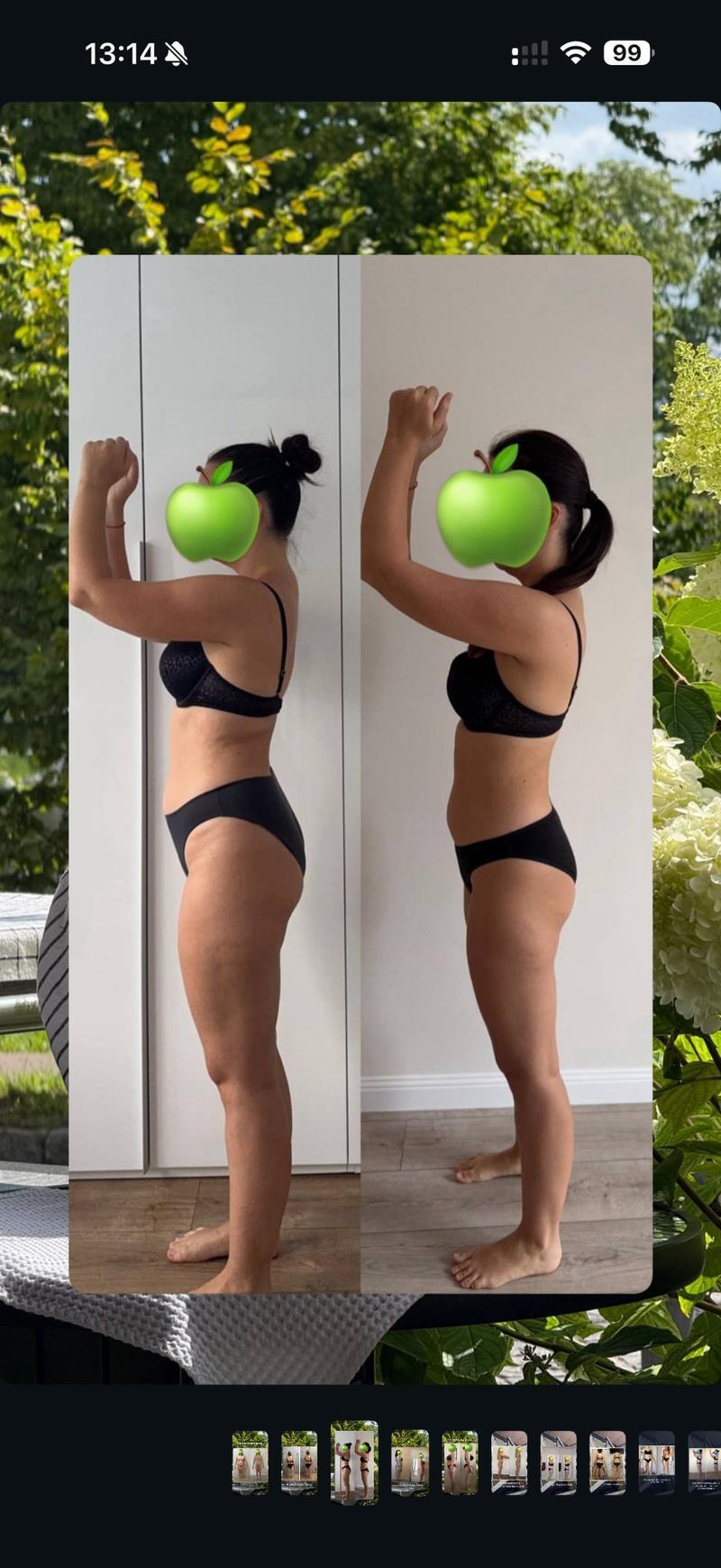 До и после ХМРЗ