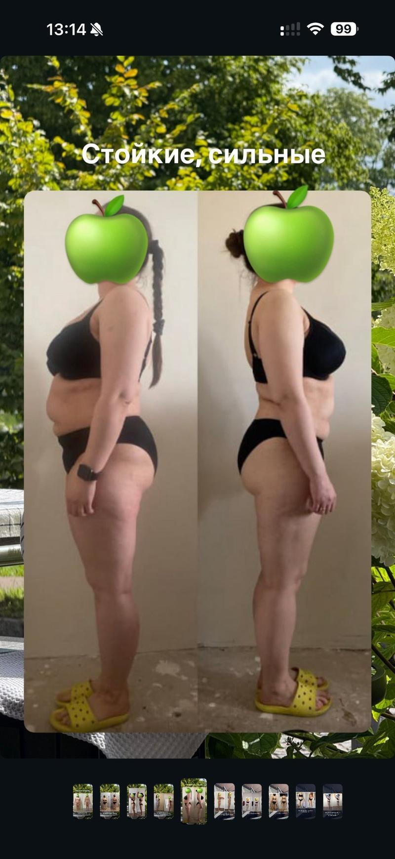 До и после ХМРЗ