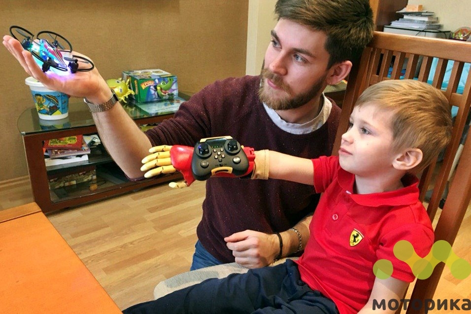 Компания моторика. Компания моторика бионические протезы. Детские протезы рук.