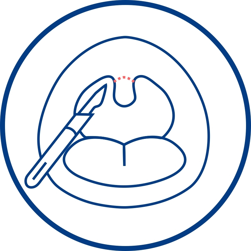 Bipap-терапия и что такое BiPAP-терапия? Его отличие от СИПАП-терапии