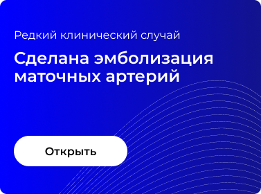 CДЕЛАНА ЭМБОЛИЗАЦИЯ МАТОЧНЫХ АРТЕРИЙ