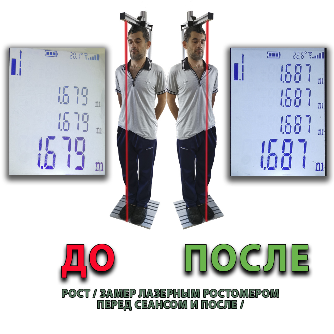 Фото ежедневного котроля динамики восстановления позвоночника при помощи лазерного ростомера. Зал Оздоровительных Практик в Анапе. 9ти дневный семинар.