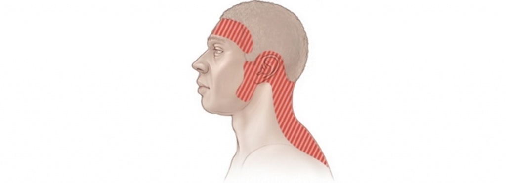 Головная боль напряжения | Симптомы, диагностика, лечение | Доктор Котляр