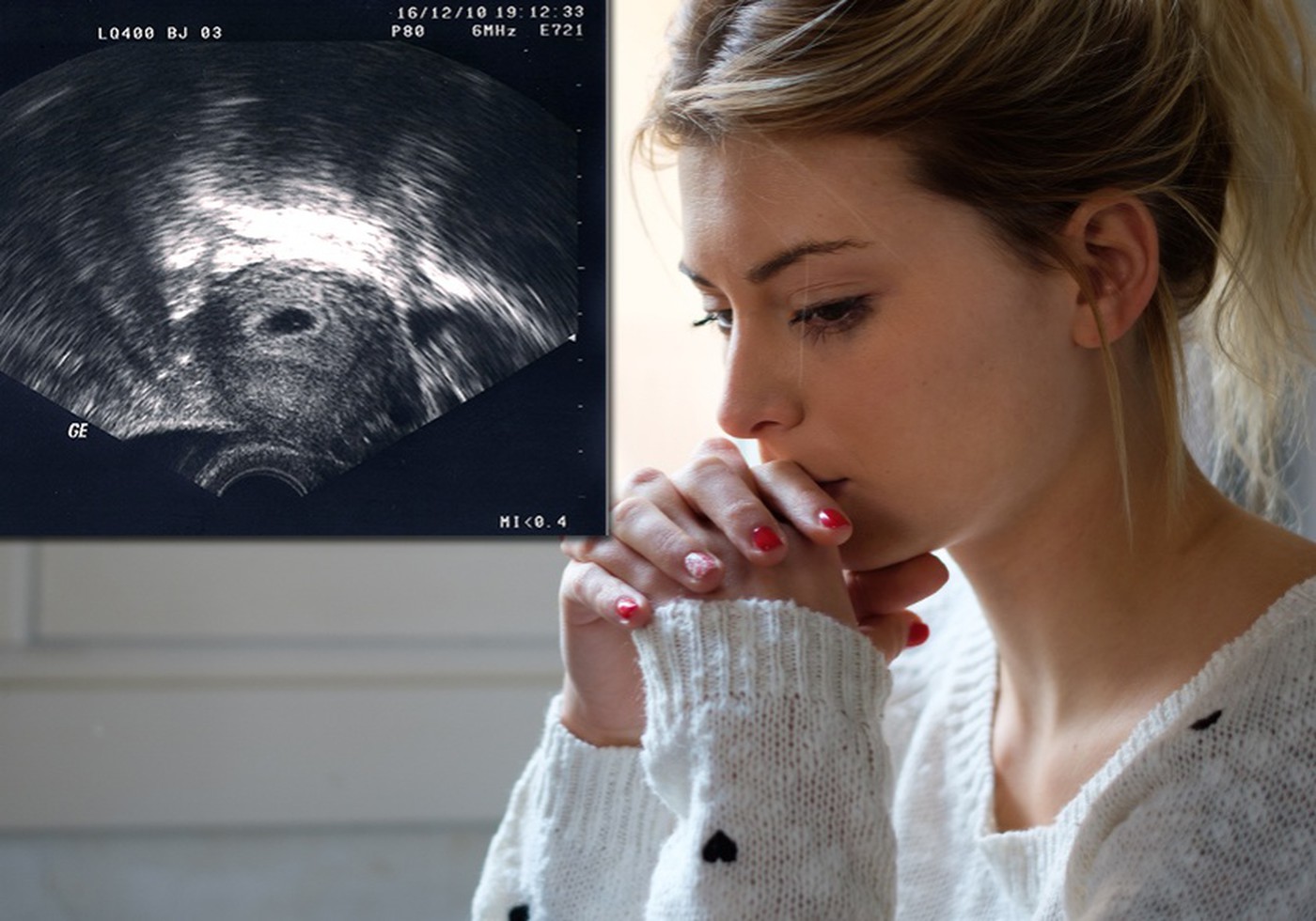 Женщина плачет после аборта
