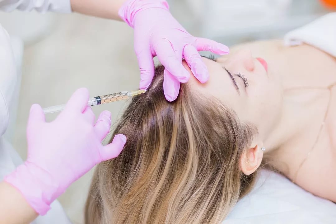Показания к процедуре плазмолифтига для волос и кожи головы