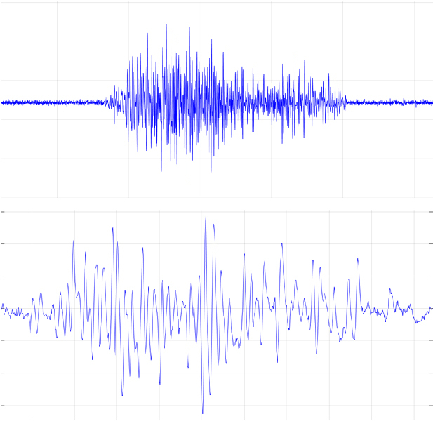 Electromyogram. What it it?