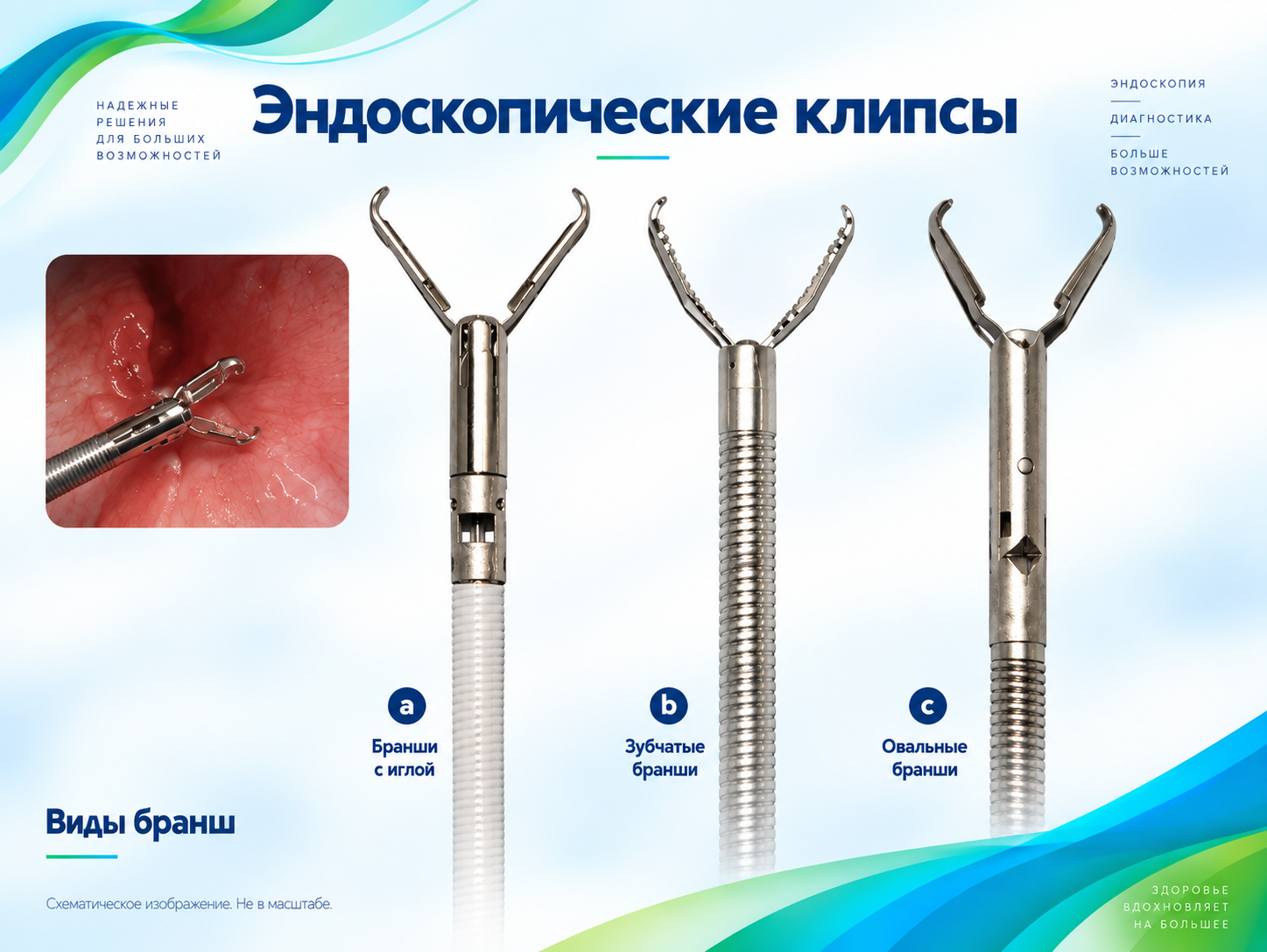 Эндоскопические клипсы