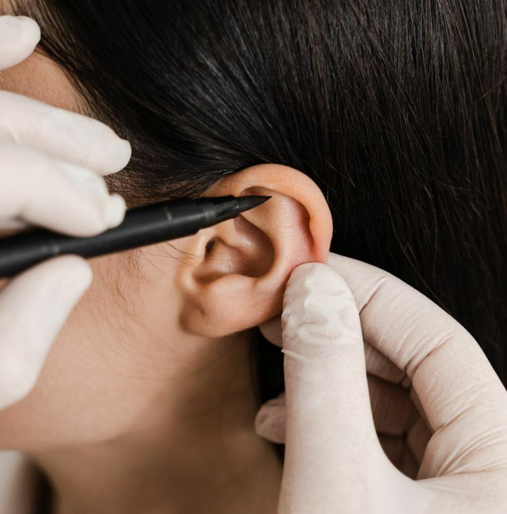 Отопластика у детей — коррекция лопоухости