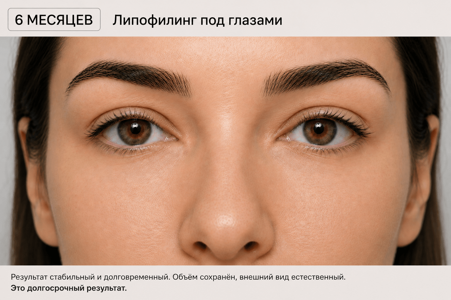 полгода после