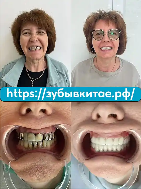 До и после — кейс 9