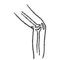 Колени