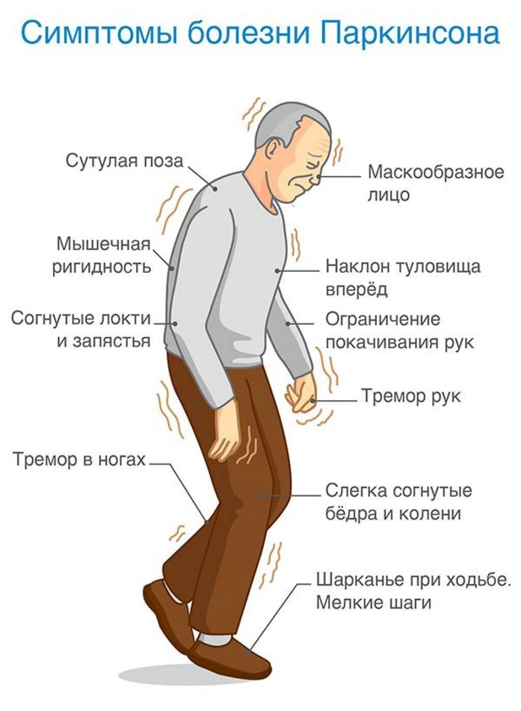 Психоз на фоне деменции